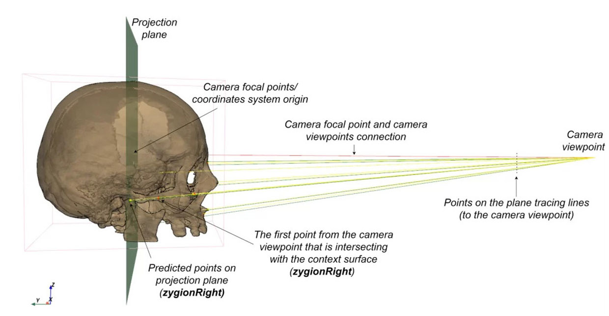 Computer vision in healthcare - AI pre-surgical planning reducing CT analysis from 3 hours to under 60 seconds